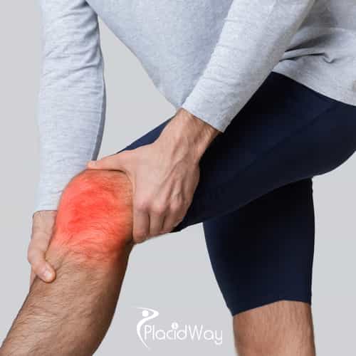 Knee Replacement in Turkey for German Patients: Cost and Post-Op Care Guide